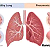 Post: PNEUMONIA: CAUSES/MODE OF TRANSMISSION, SYMPTOMS AND ITS EFFECTSPneumonia is a serious infection...